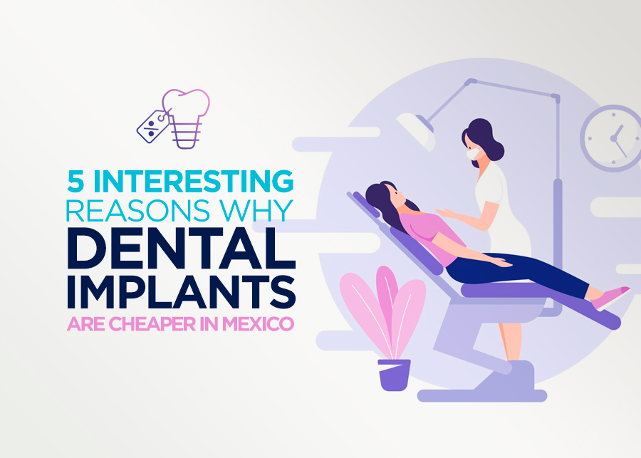 5 Interesting Reasons Why Dental Implants are Cheaper in Mexico