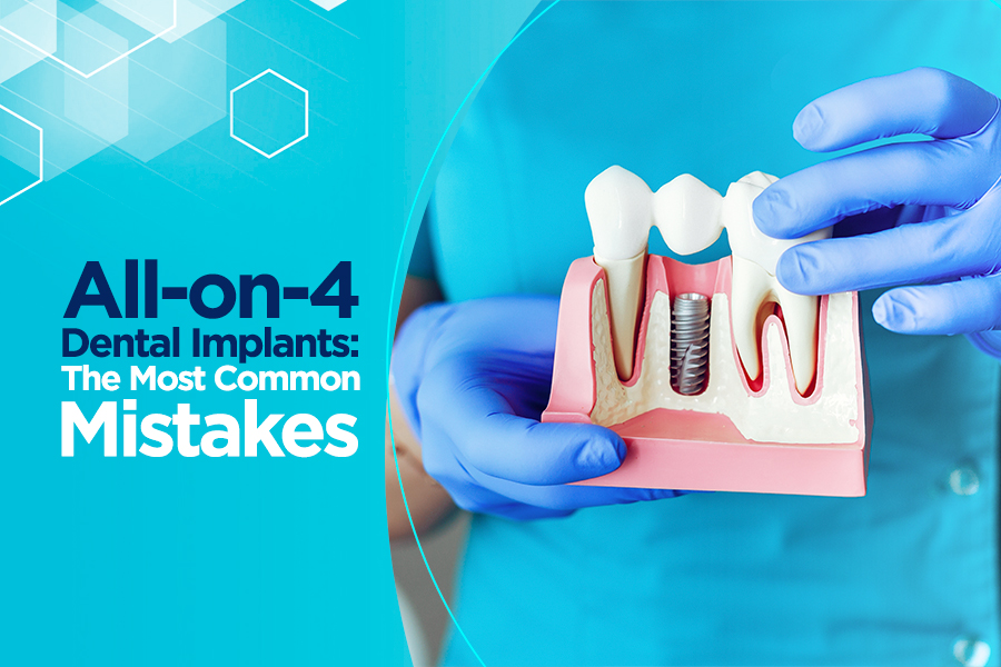 All-on-4 Dental Implants: The Most Common Mistakes