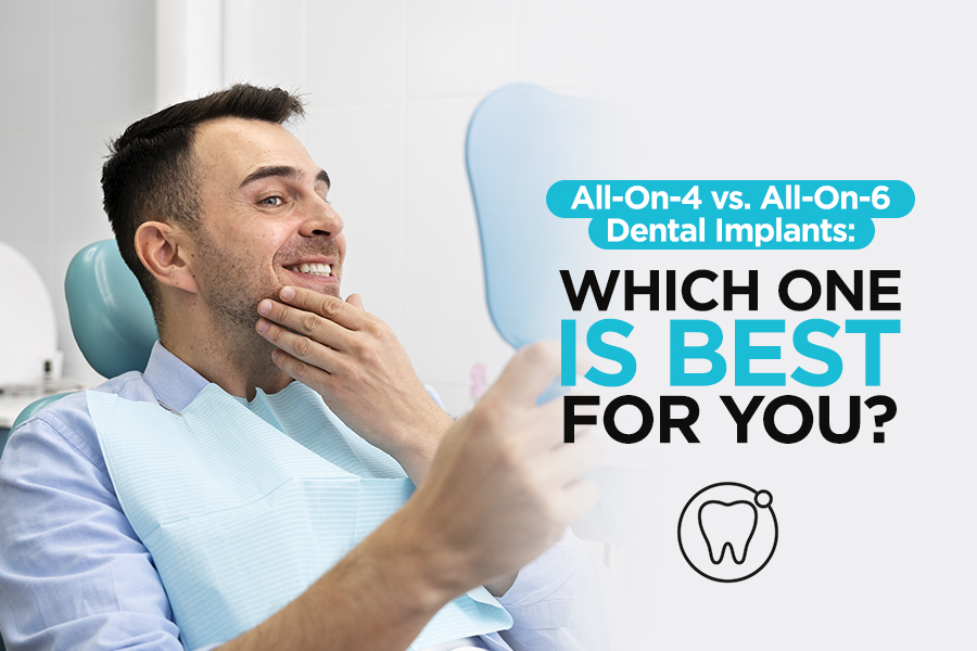 All-On-4 vs. All-On-6 Dental Implants: Which One is Best For You?