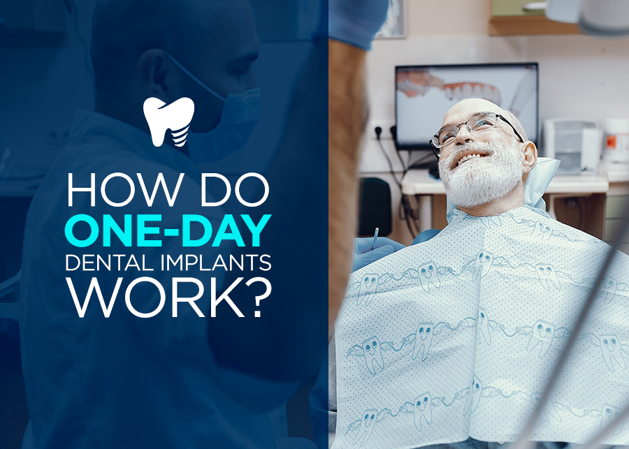How Do One-Day Dental Implants Work?