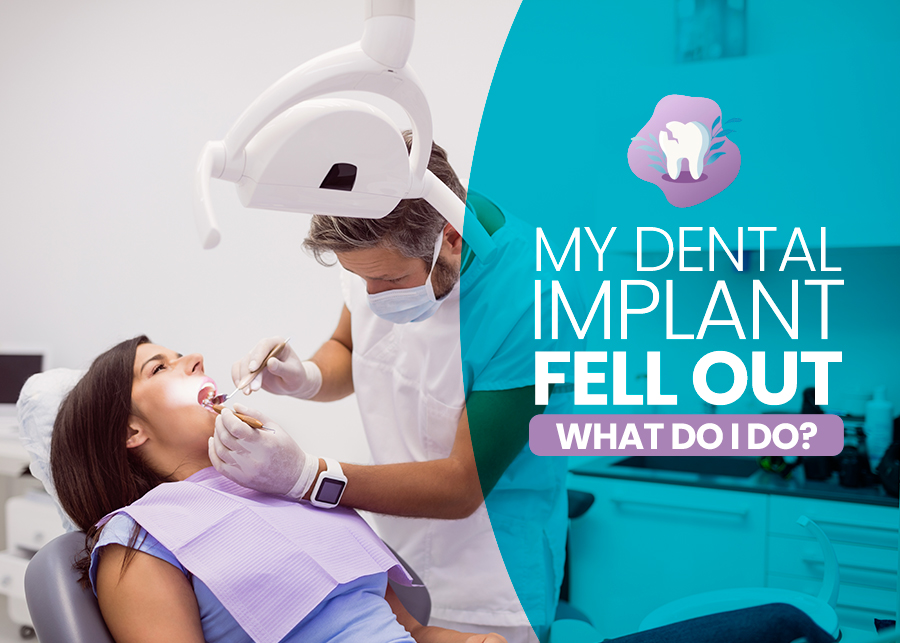 My Dental Implant Fell Out – What Do I Do?