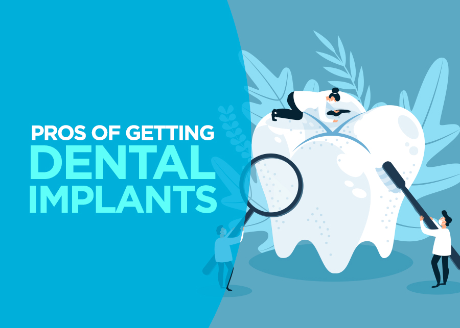 Pros of Getting Dental Implants