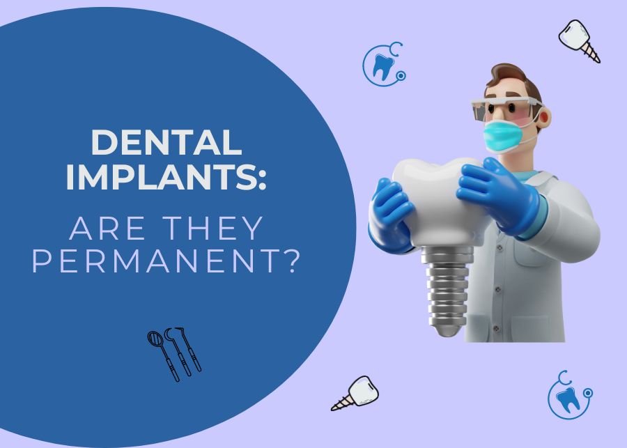 Dental Implants: Are They Permanent?