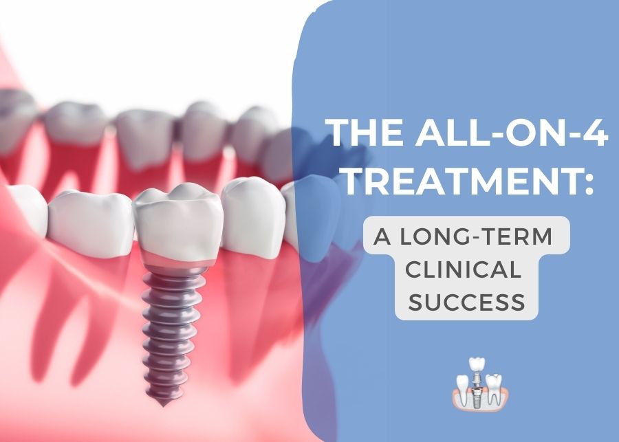 The All-on-4 Treatment: A Long-Term Dental Clinical Success