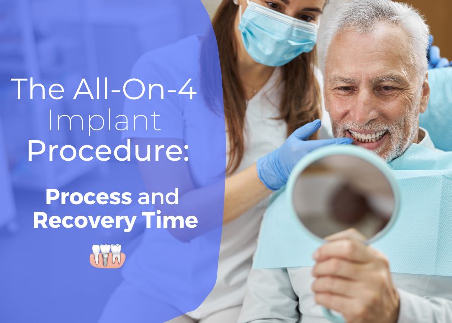 The All-On-4 Implant Procedure: Process and Recovery Time