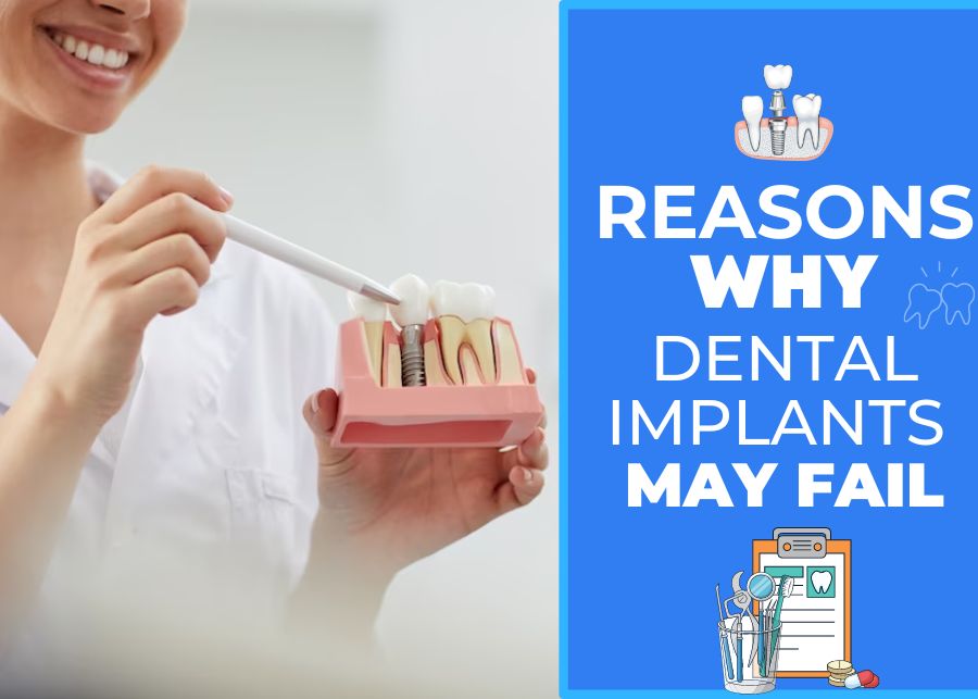 Reasons Why Dental Implants May Fail