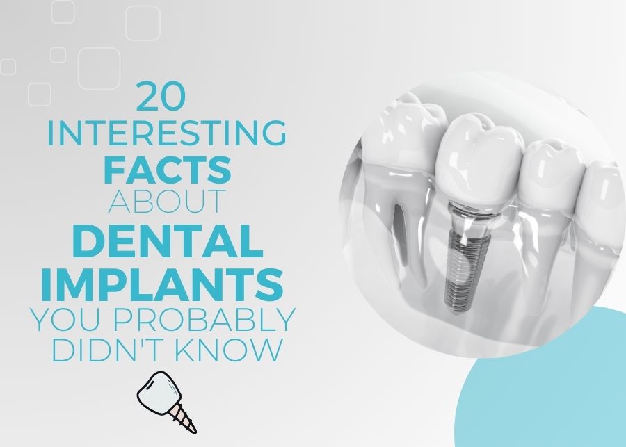 20 Facts About Dental Implants You Probably Didn’t Know