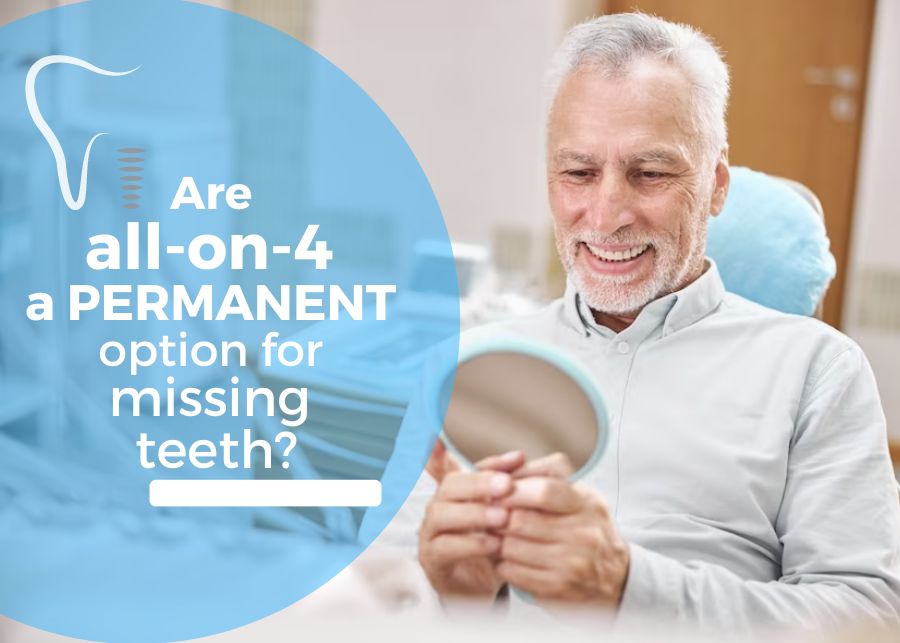 Are All-on-4 A Permanent Option For Missing Teeth?