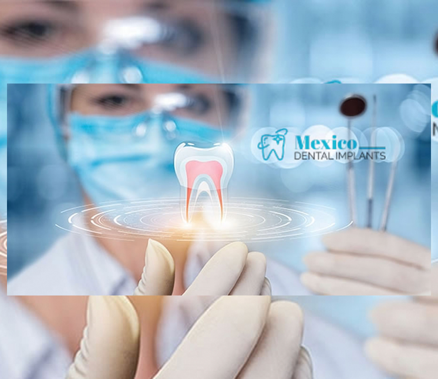 Mexico Dental Implants logo featured on top of an image of a dental care professional holding tools and wearing gloves and goggles.
