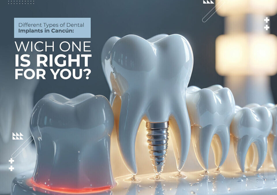 Different Types of Dental Implants in Cancun: Which One is Right for You?