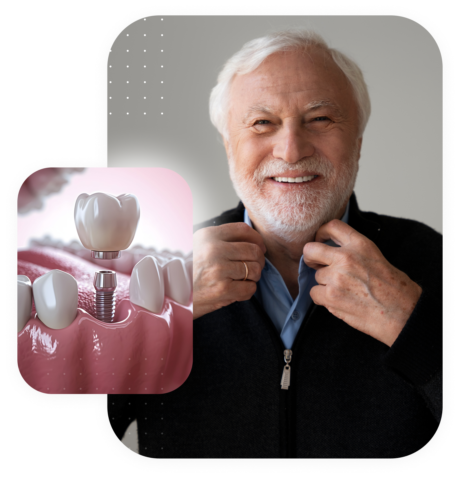 Same Day Dental Implants - Pacient smile