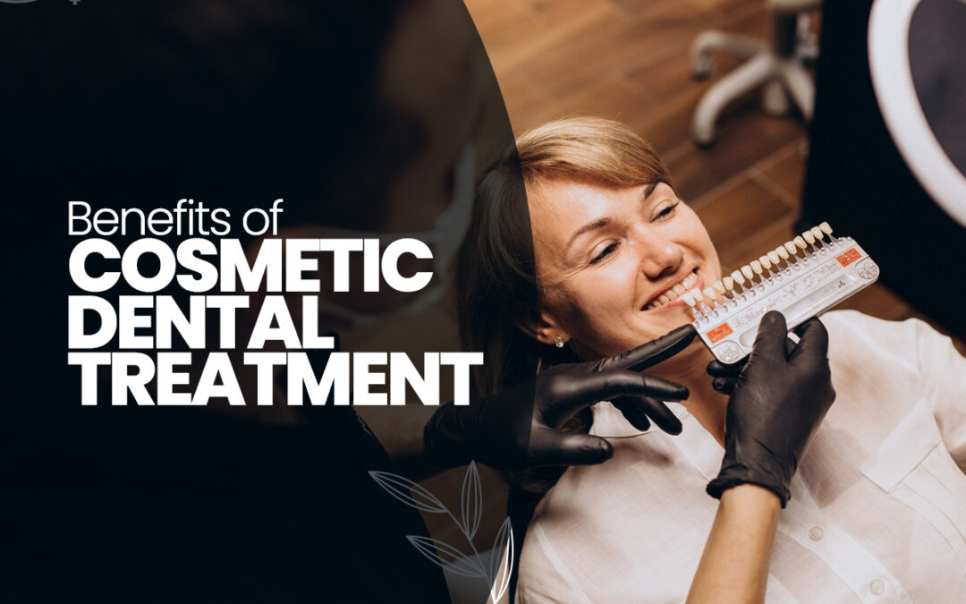 Benefits of Cosmetic Dental Treatment