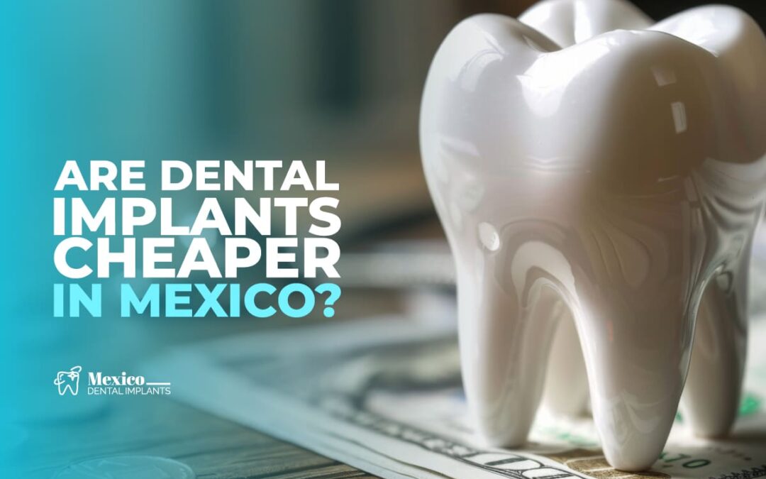 Are Dental Implants Cheaper in Mexico?