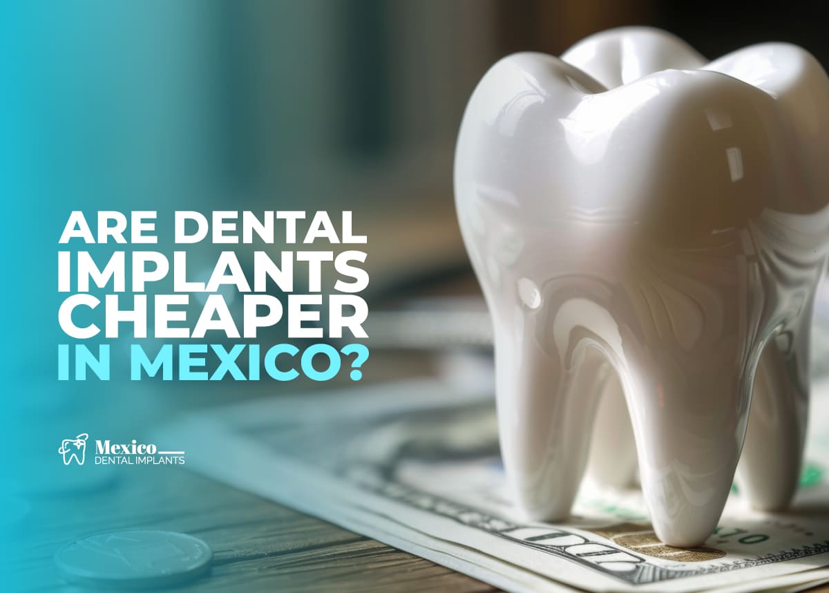 Dental Implants in Mexico vs USA