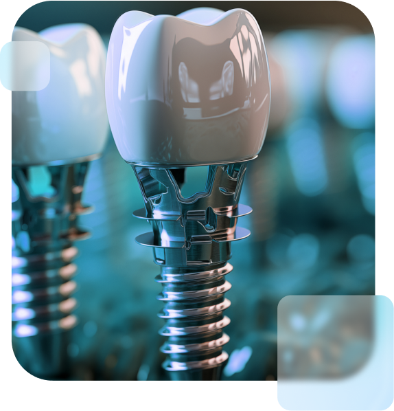 Dental Implant Systems