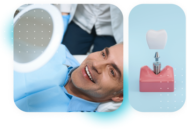 All on 6 Dental implants in Guadalajara & Cancun