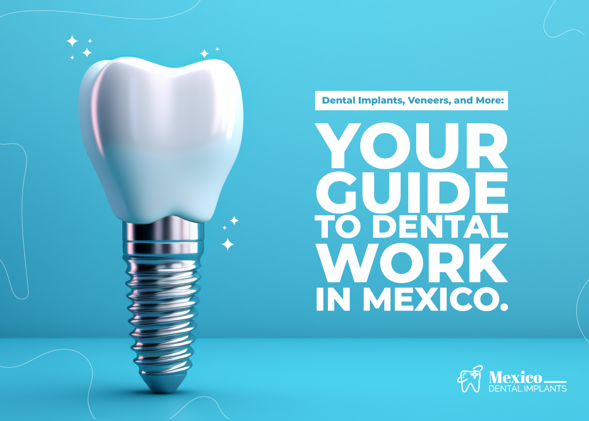 Dental Implants in Mexico vs USA