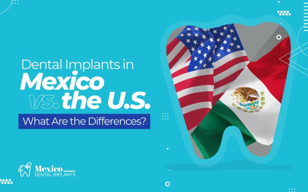 Dental Implants in Mexico vs. the U.S.: What Are the Differences?