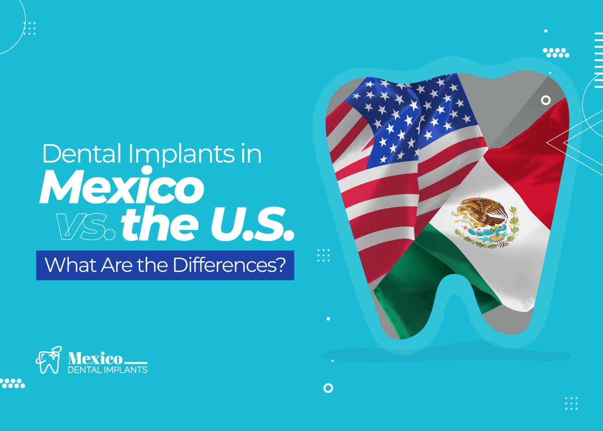 Dental Implants in Mexico vs USA