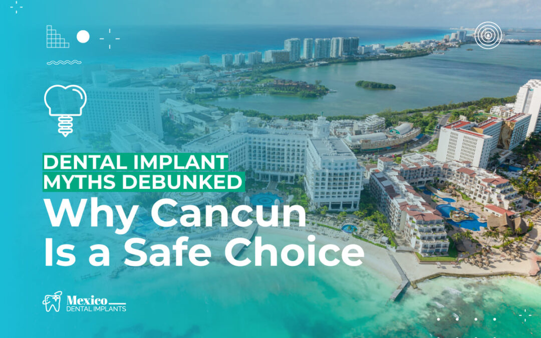 Dental Implant Myths Debunked: Why Cancun Is a Safe Choice