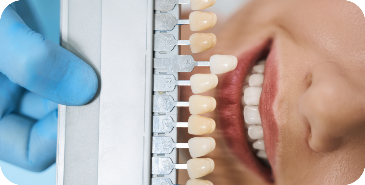 Dental protection during Physical Activities