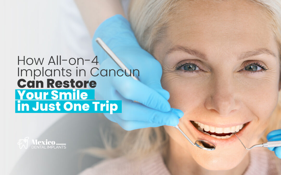 How All-on-4 Implants in Cancun Can Restore Your Smile in Just One Trip