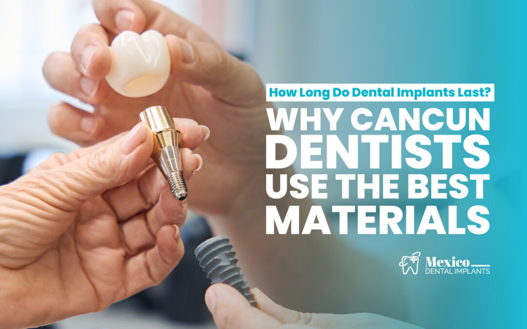 How Long Do Dental Implants Last? Why Cancun Dentists Use the Best Materials