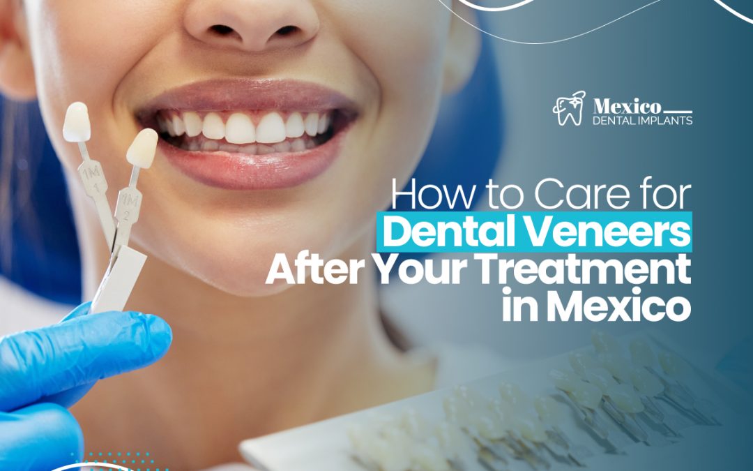 How to Care for Dental Veneers After Your Treatment in Mexico