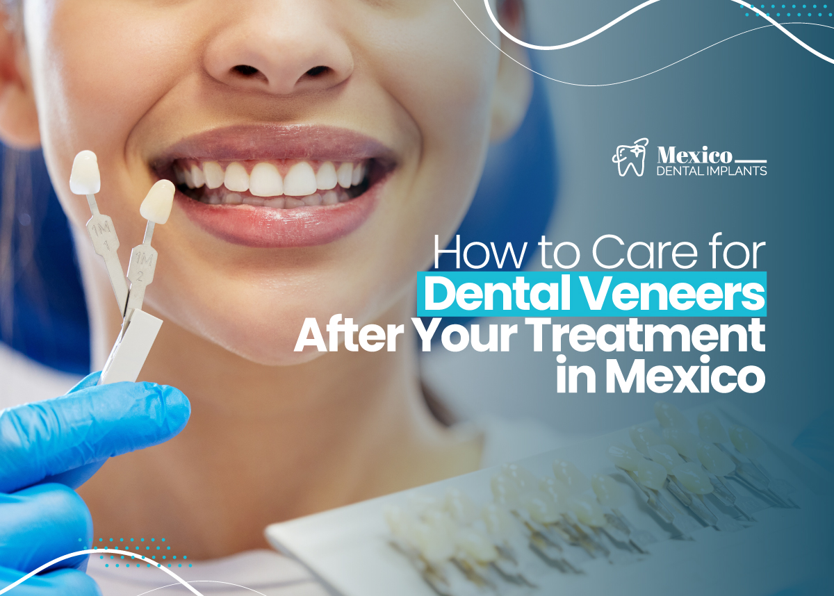 Dental Implants in Mexico vs USA