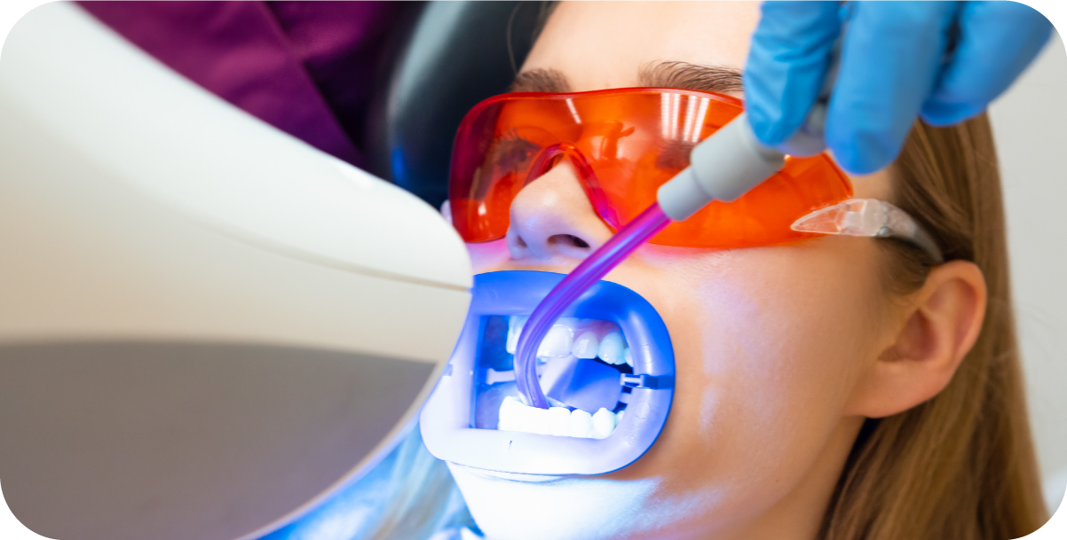 Stain and Discoloration, dental Care in mexico