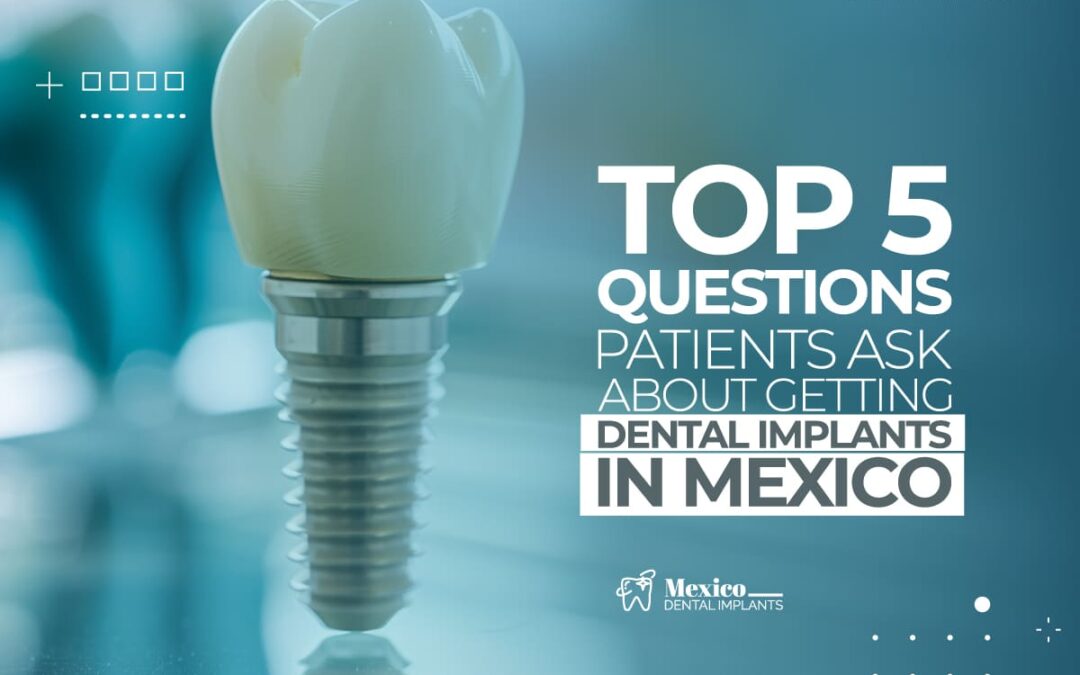 Top 5 Questions Patients Ask About Getting Dental Implants in Mexico