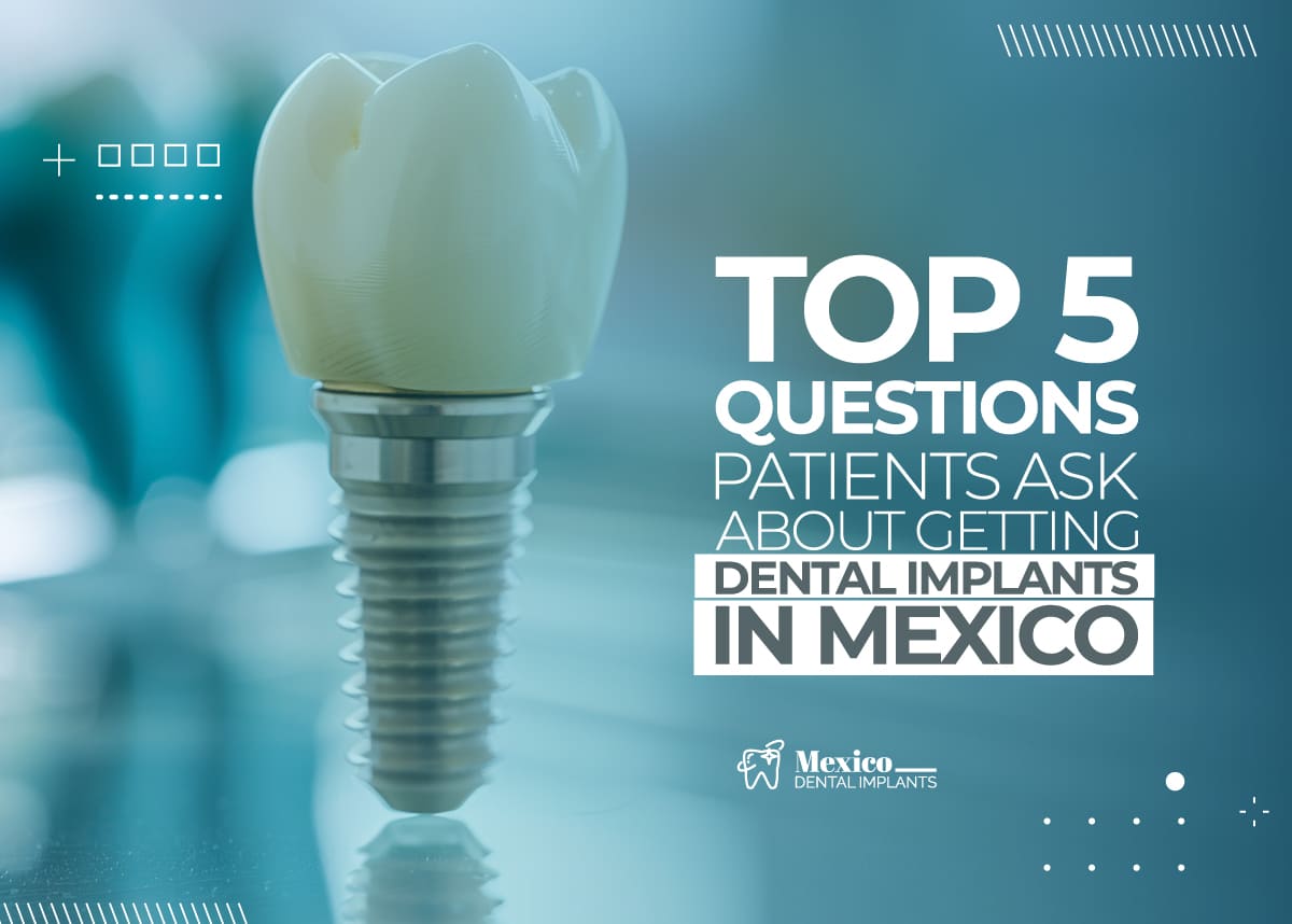 Top-5-Questions-Patients-Ask-About-Getting-Dental-Implants-in-Mexico Dental Implants in Mexico vs USA