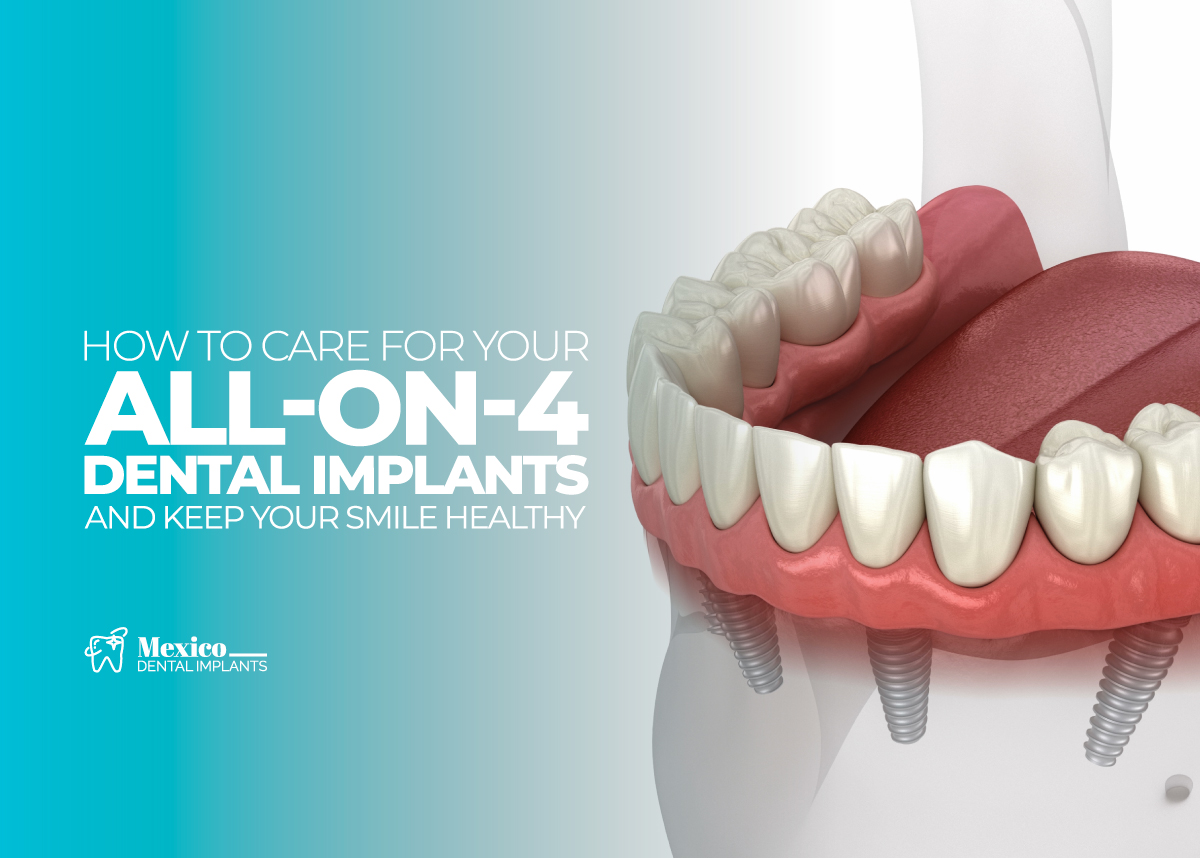 featured-How-to-Care-for-Your-All-on-4-Dental-Implants-and-Keep-Your-Smile-Healthy Dental Implants in Mexico vs USA
