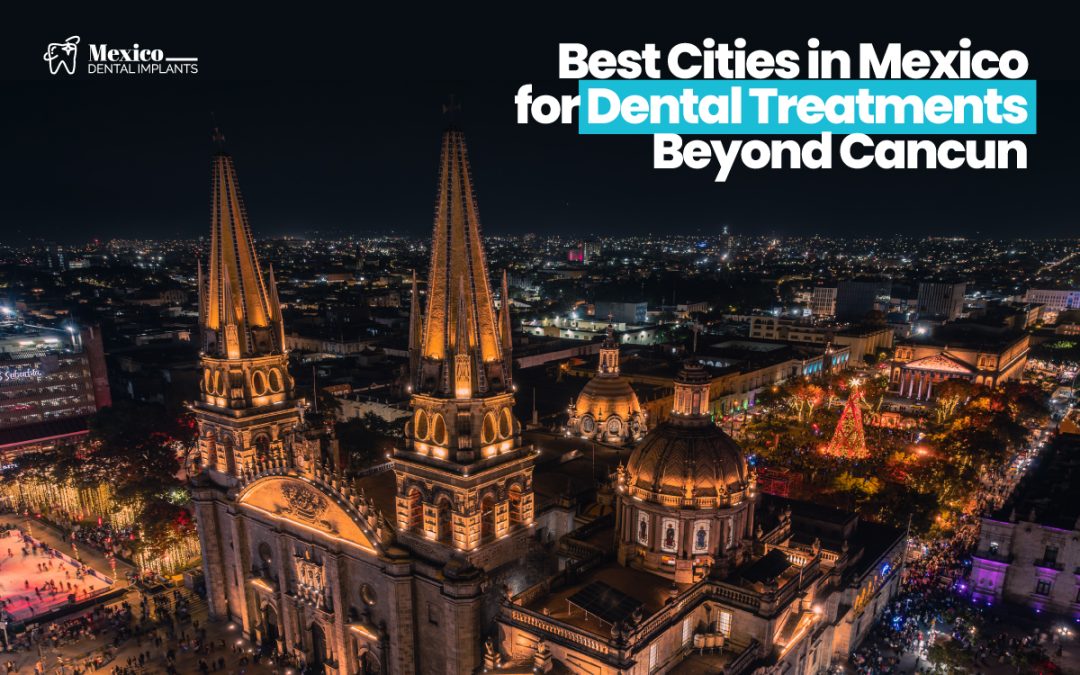 Best Cities in Mexico for Dental Treatments Beyond Cancun