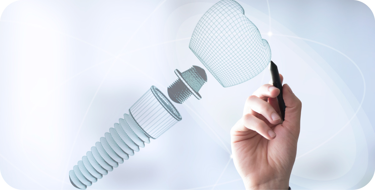 Mini Dental Implants