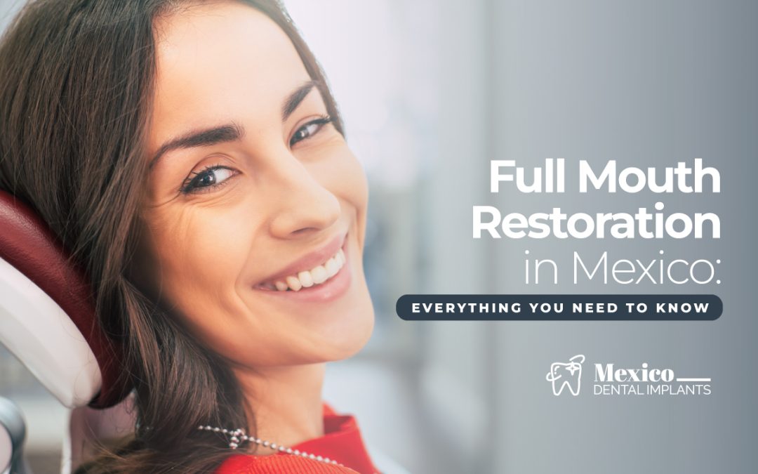 Full Mouth Restoration in Mexico: Everything You Need to Know