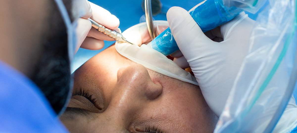 Who is a Candidate for Full Mouth Restoration?<br />
