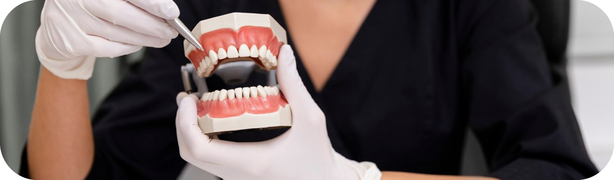 What is Osseointegration in Implants?